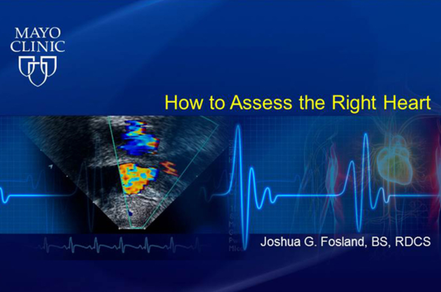 How to Assess the Right Heart