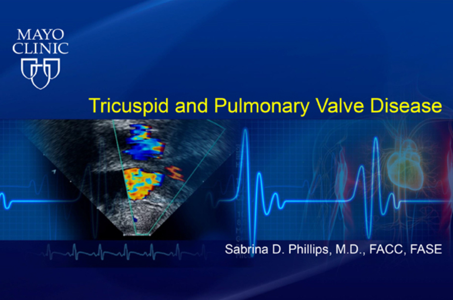 BUNDLE - Tricuspid and Pulmonary Valve Diseases, Right Ventricular Function and Pulmonary Hypertension, How to Assess the Right Heart