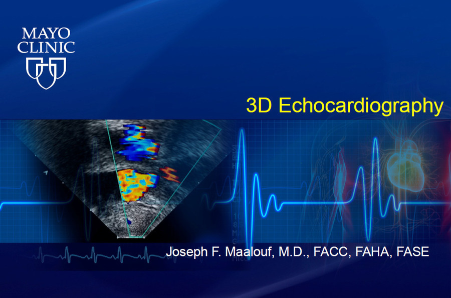 3D Echocardiography