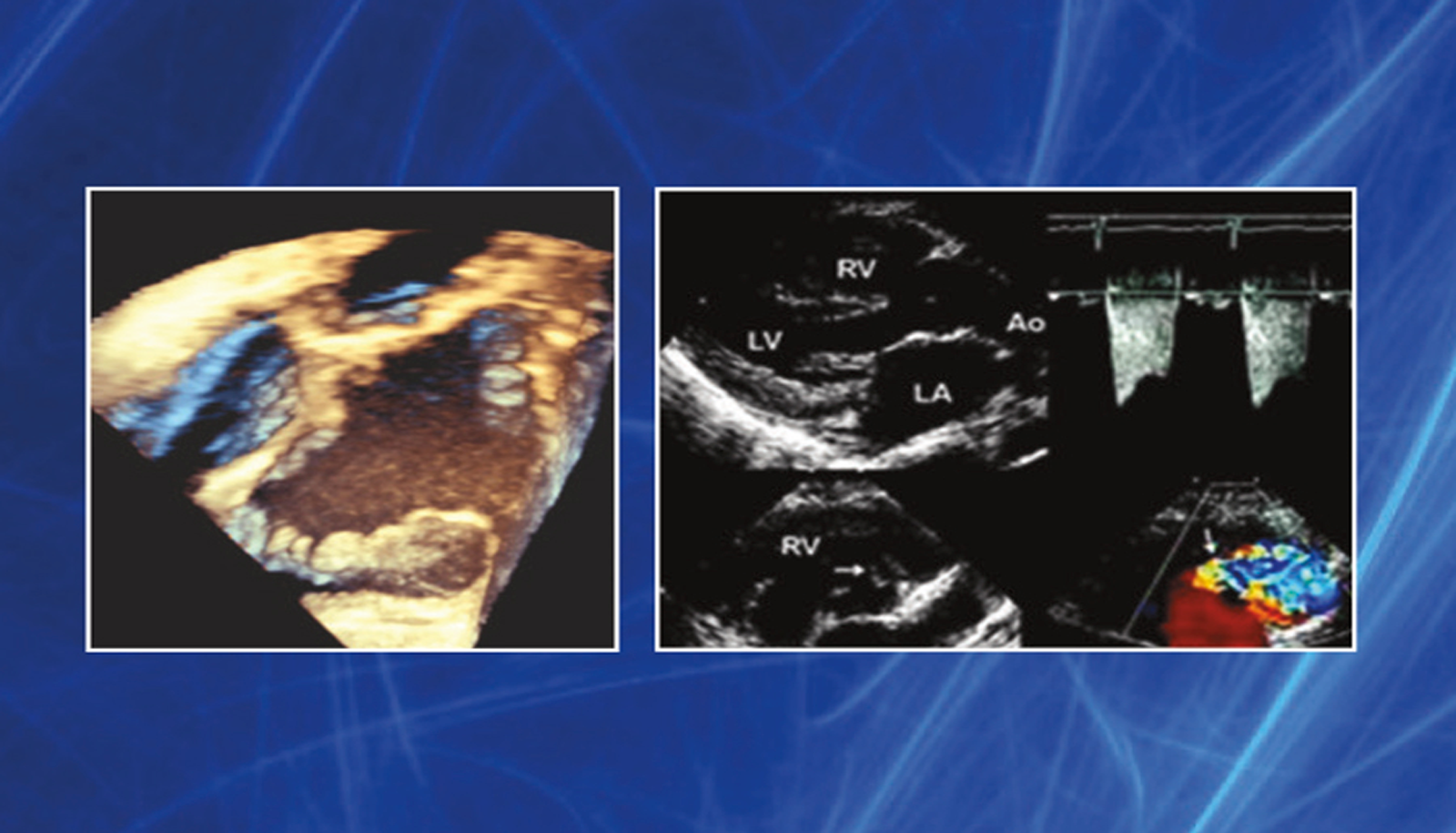 Echocardiography in Pediatric and Adult Congenital Heart Disease Case Studies: Including Multimodality Imaging