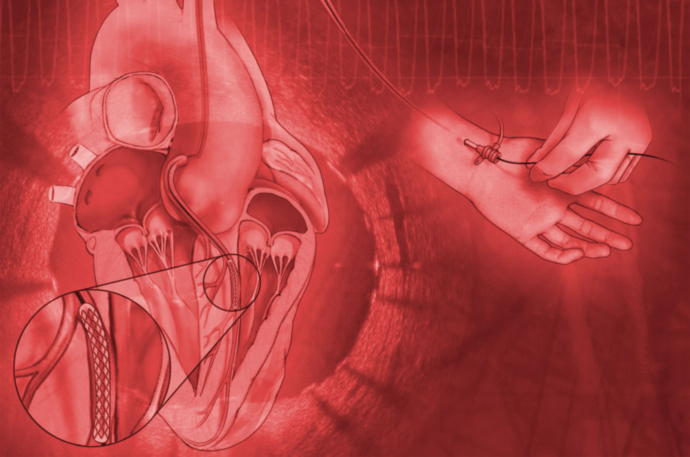 Interventional Cardiology Online Board Review