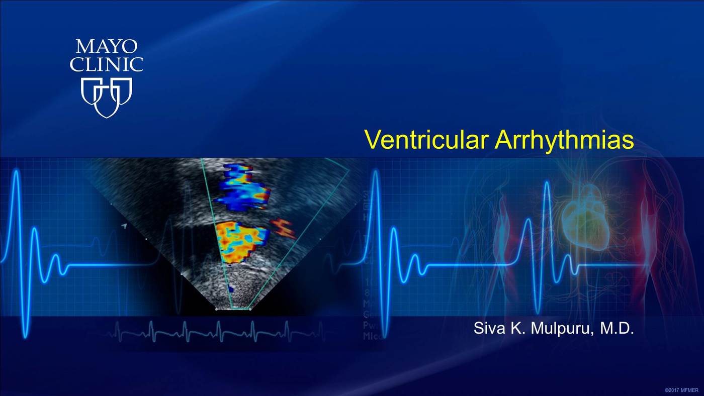 Ventricular Arrhythmias