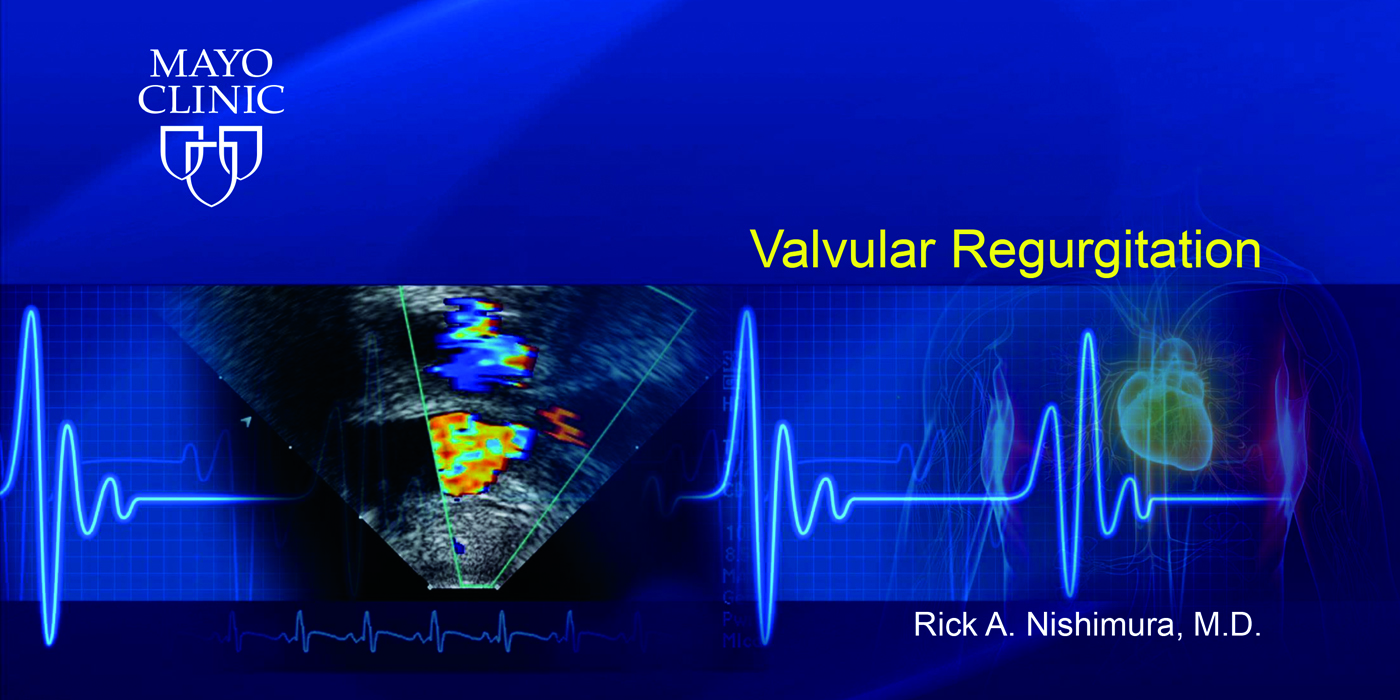 Valvular Regurgitation