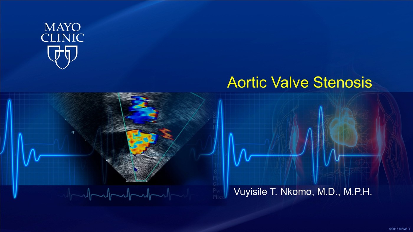 Aortic Valve Stenosis