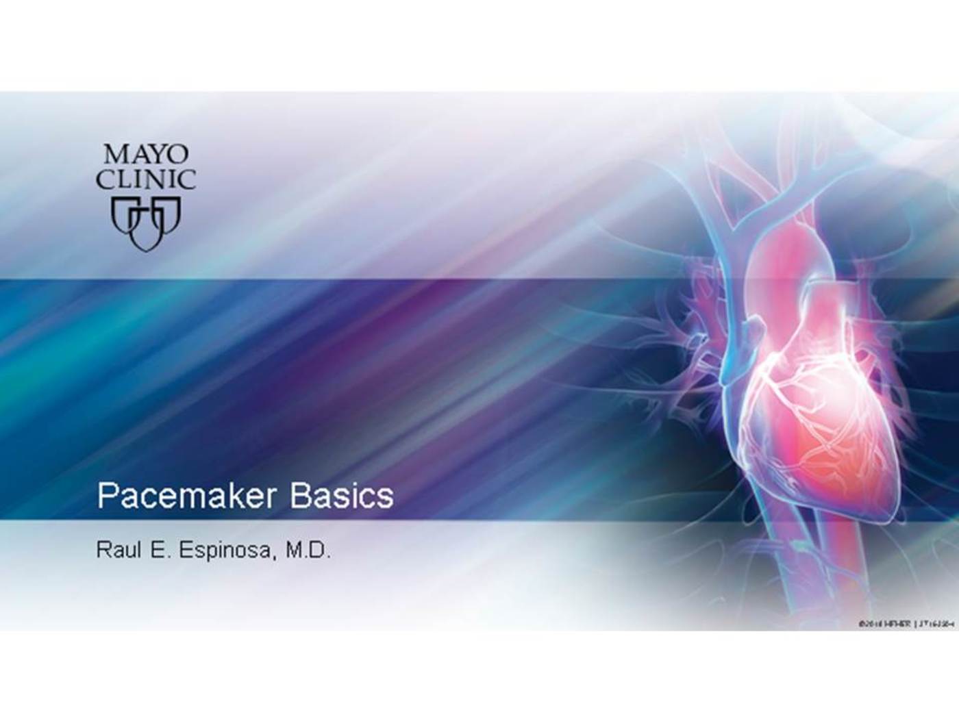 Pacemaker Basics