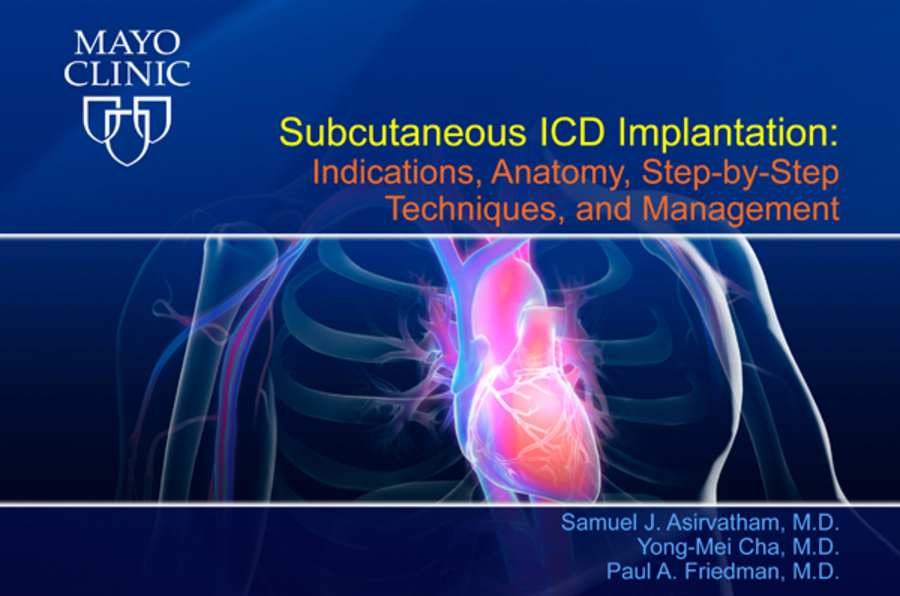 Subcutaneous ICD Implantation: Indications, Anatomy, Step-by-Step Techniques, and Management