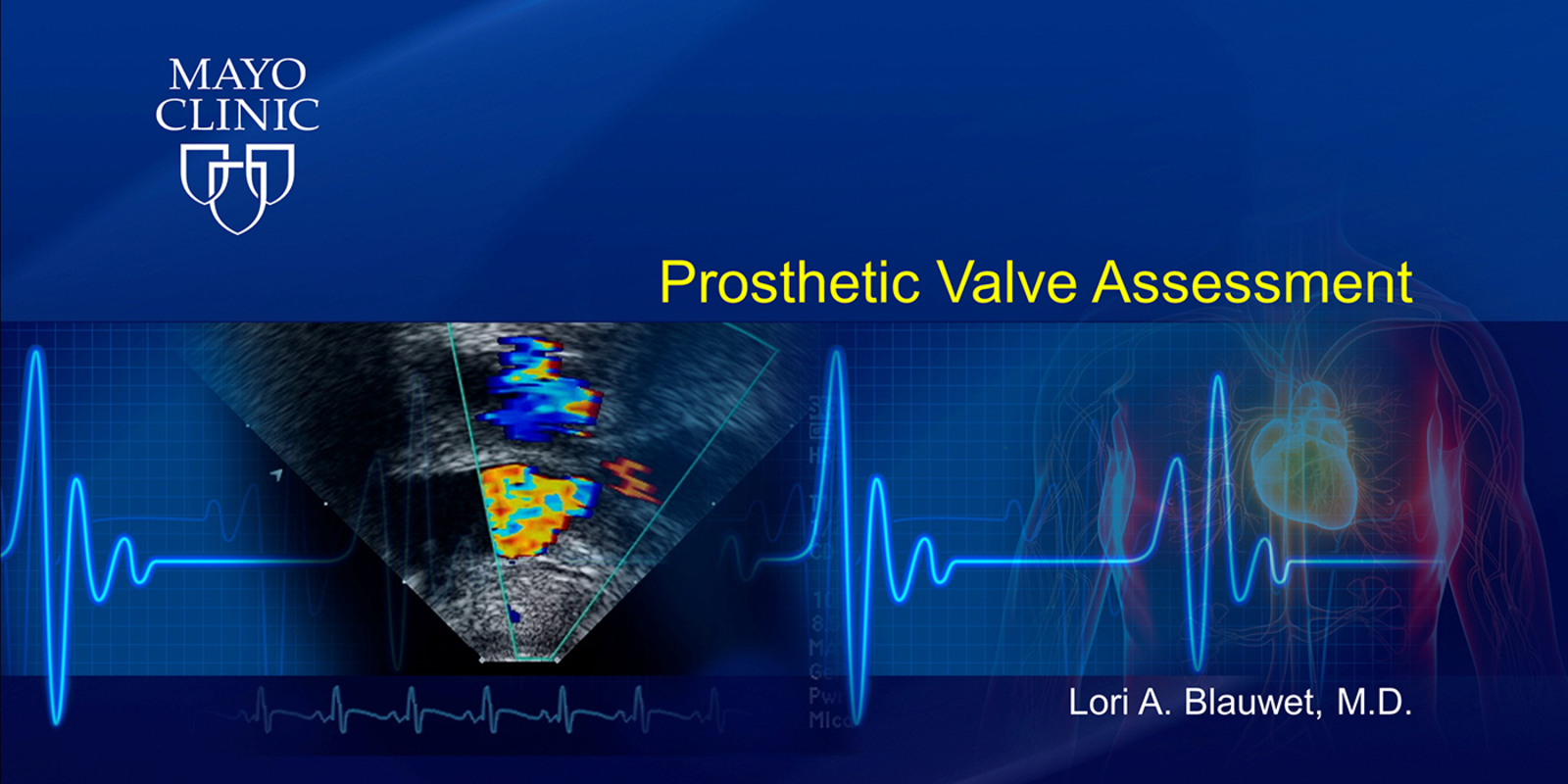 Prosthetic Valve Assessment