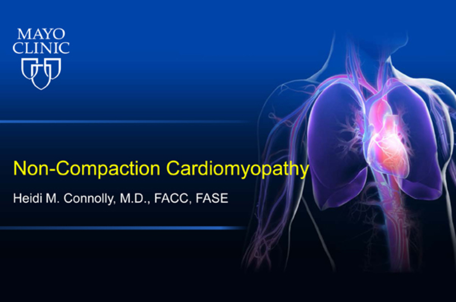 Non-Compaction Cardiomyopathy