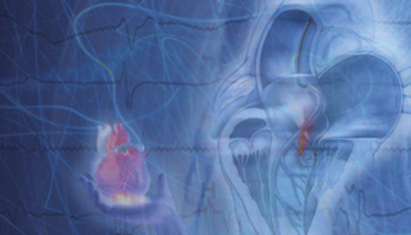 Cardiovascular Online Board Review