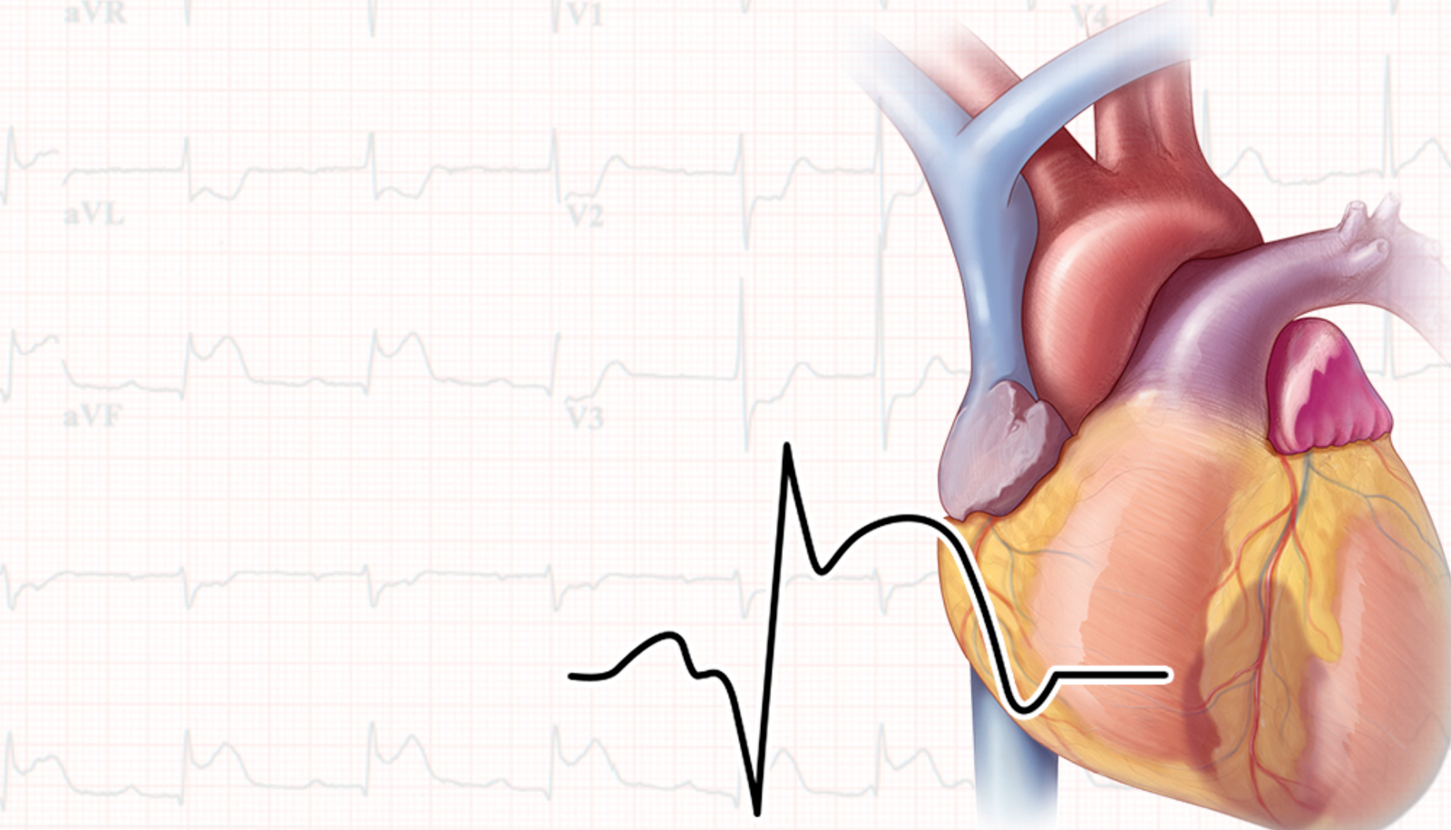 cardiology in cancun