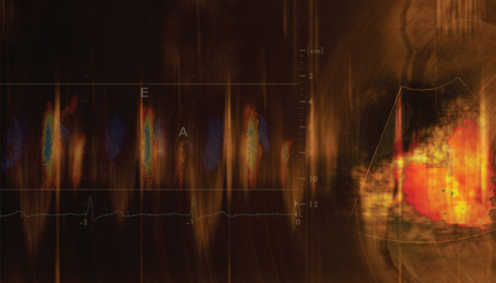 Mayo Clinic Echocardiography Review Course for Boards and Recertification