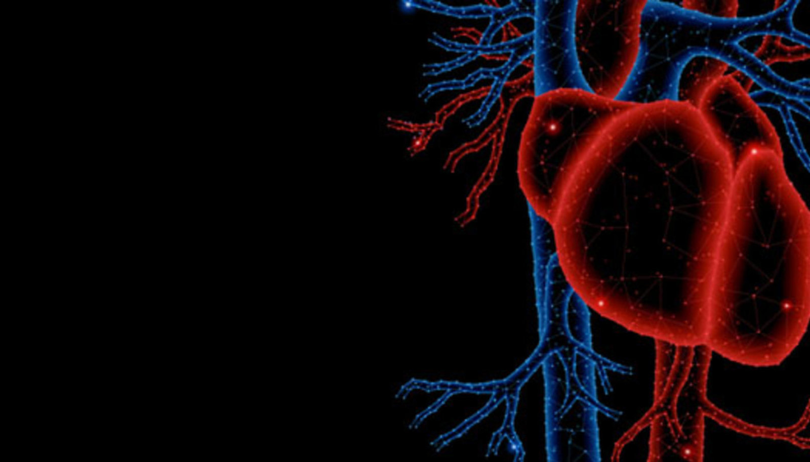 Webinar: Approach to Inflammatory Cardiomyopathy 
