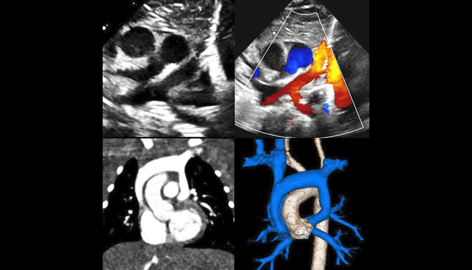 41st Annual Morphology and Imaging in Congenital Heart Disease:   The Key to Diagnosis and Management at All Ages