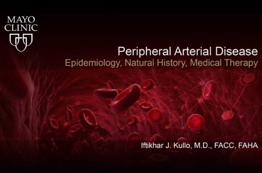 Peripheral Arterial Disease: Epidemiology, Natural History, Medical Therapy