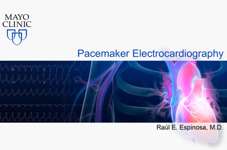 Pacemaker ECG