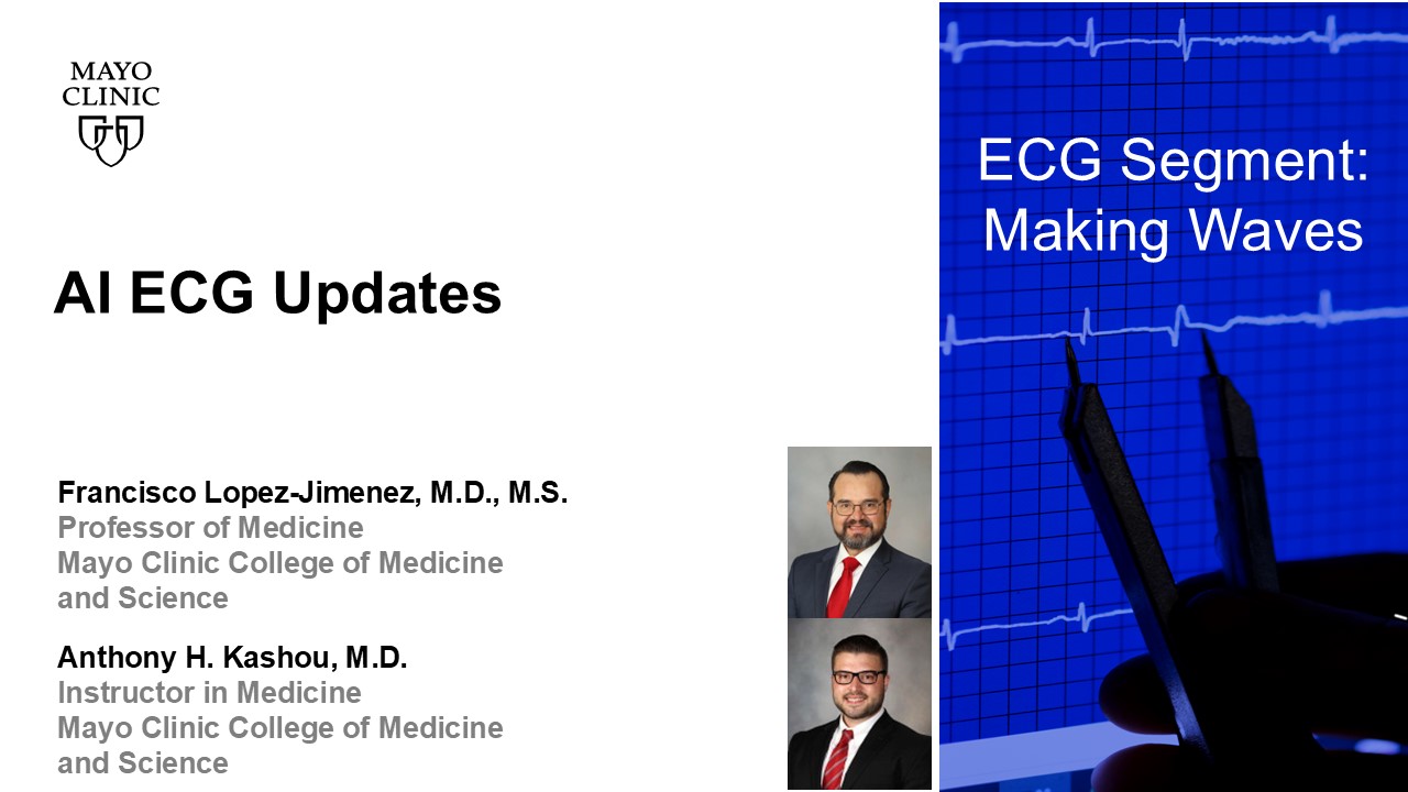 Ai ecg updates