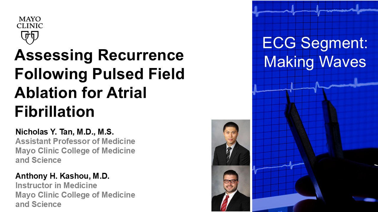 Assessing recurrence following pulsed field ablation for af