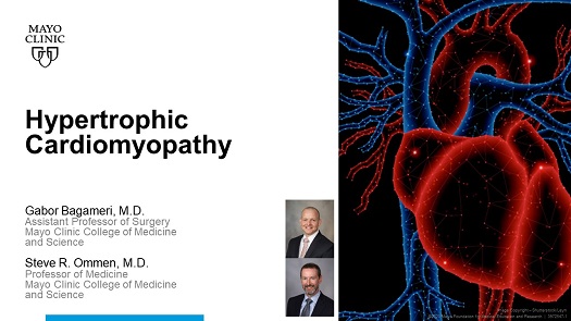 Bagameri ommen hypertrophic cardiomyopathy