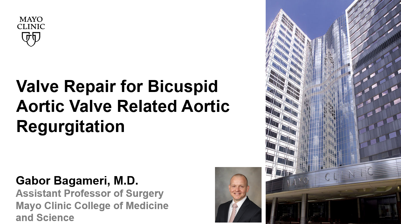 Bagameri valve repair for bicuspid aortic valve