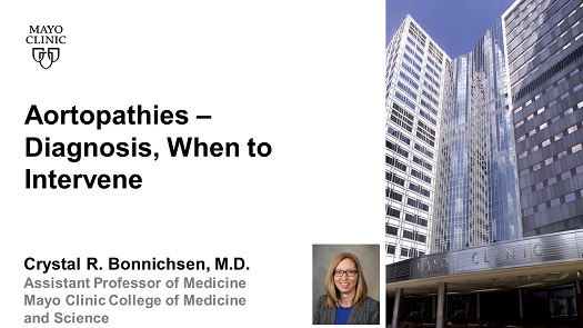 Bonnichsen aortopathies diagnosis when to intervene