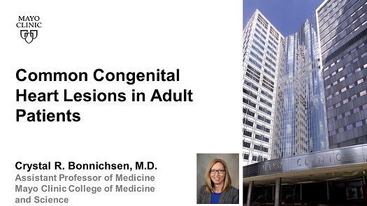 Bonnichsen common congenital heart lesions in adult patients