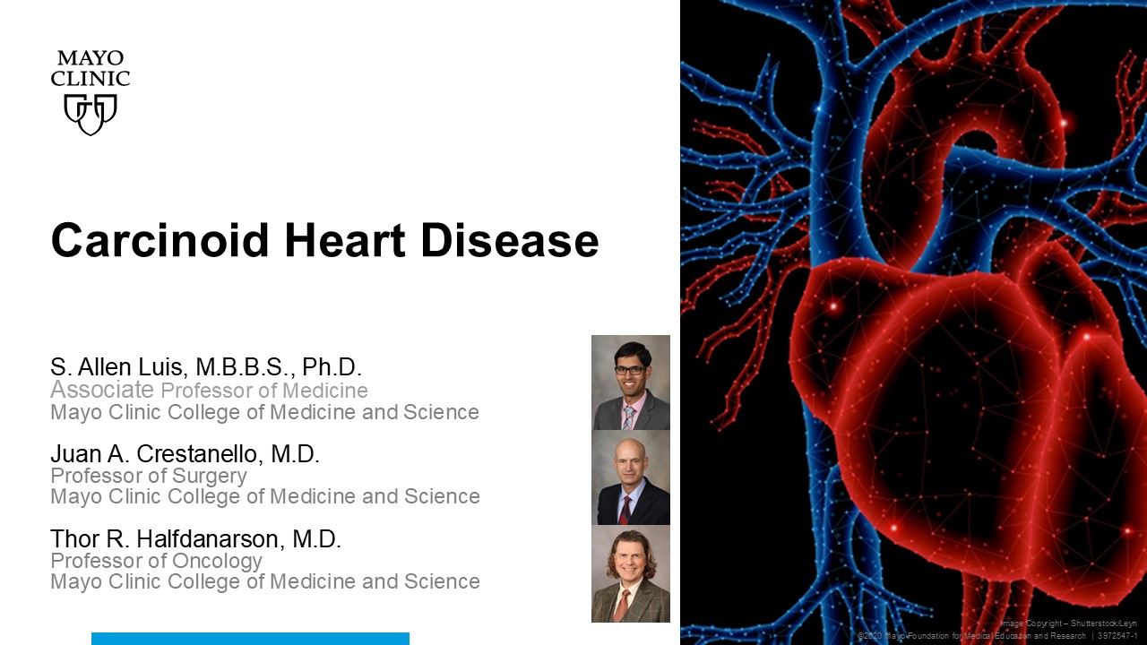 Carcinoid heart disease