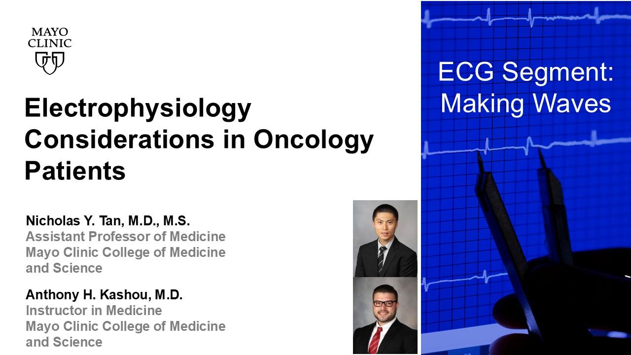 Ecg considerations in oncology patients