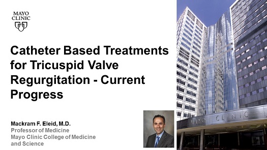 Eleid catheter based treatments for tricuspid valve regurg