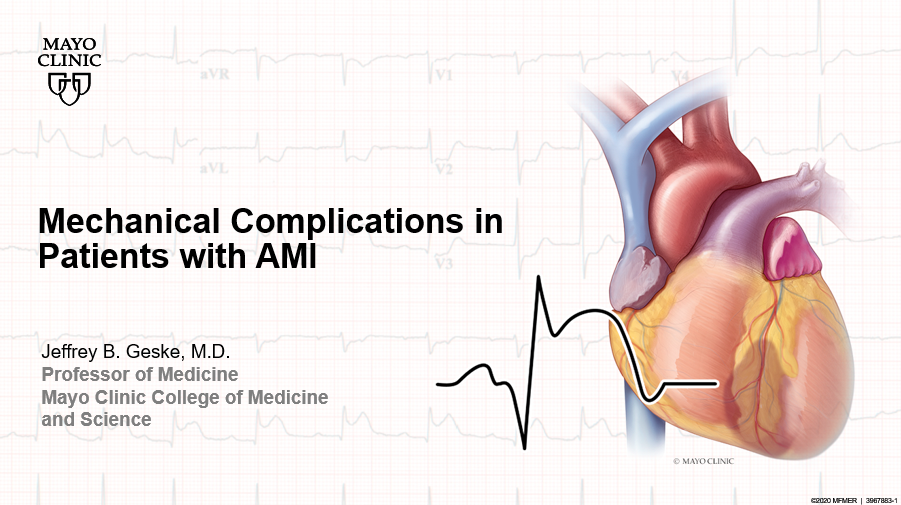 Geske mechanical complications