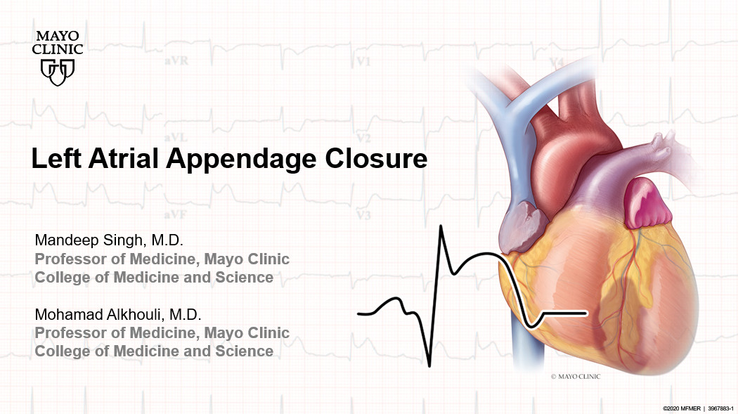 Left atrial appendage closure