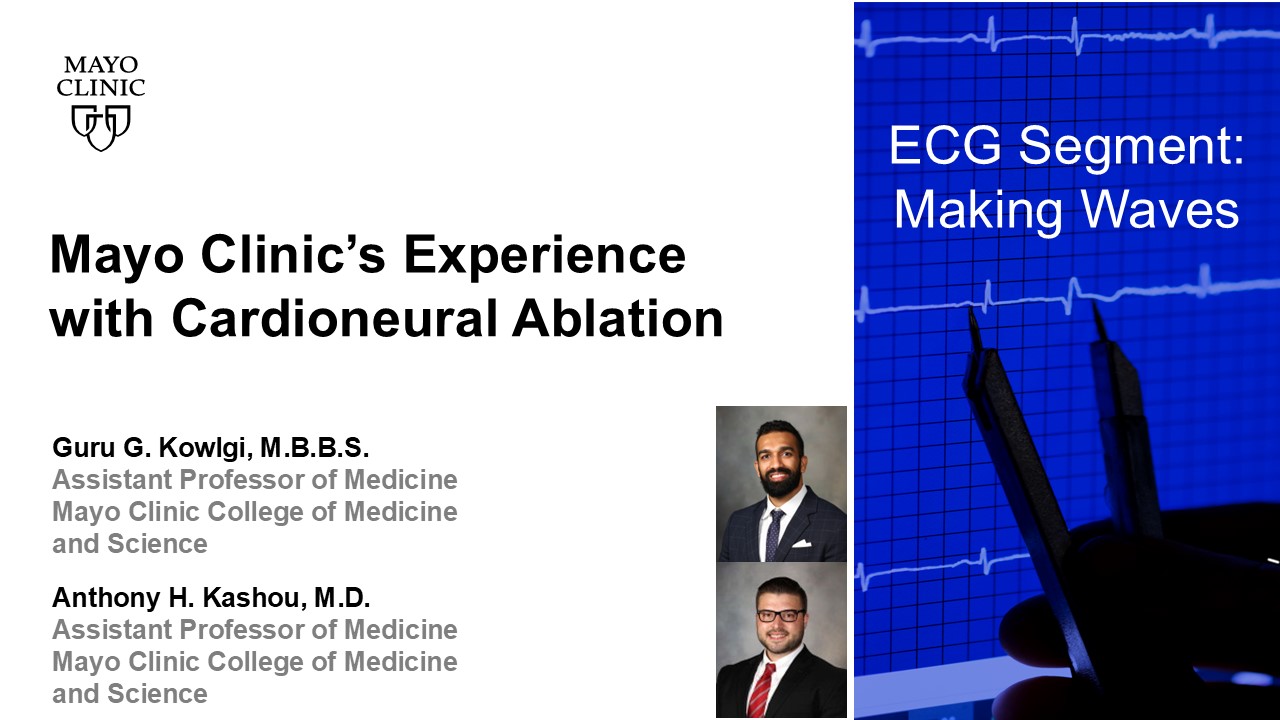 Mc experience with cardioneural ablation