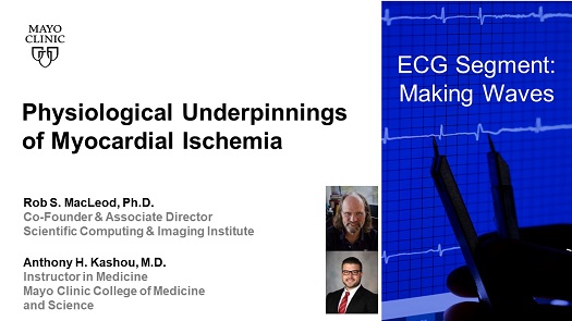 Macleod kashou physiological underpinnings of myocardial ischemia