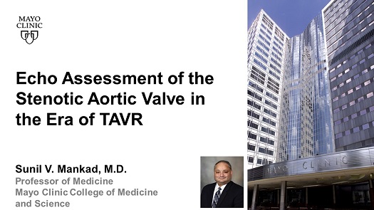 Mankad s echo assessment of the stenotic aortic valve in the era of tavr