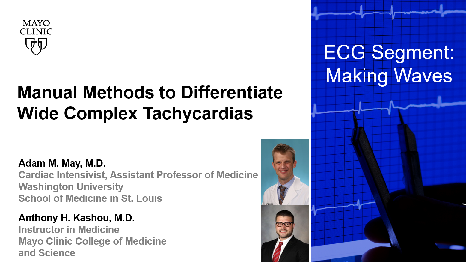 May kashou manual methods to differentiate wide complex tachycardias