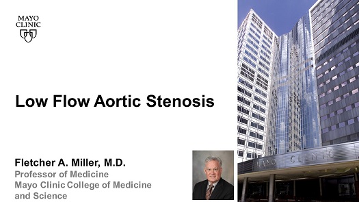 Miller low flow aortic stenosis