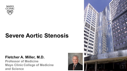 Miller severe aortic stenosis