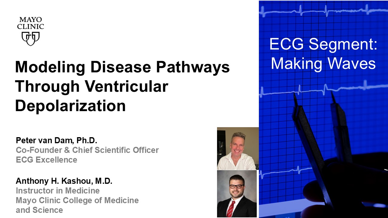 Modeling disease pathways through ventricular depolarization