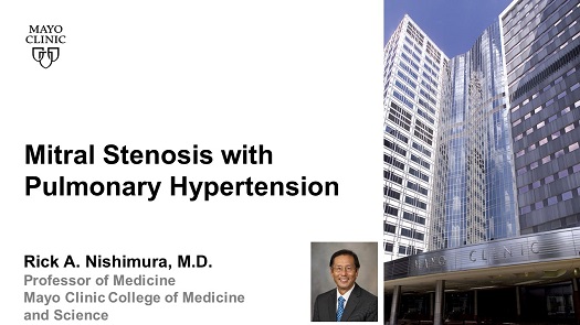 Nishimura mitral stenosis with pulmonary hypertension