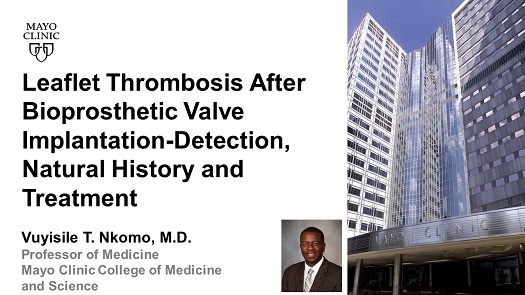 Nkomo leaflet thrombosis after bioprosthetic valve implantation