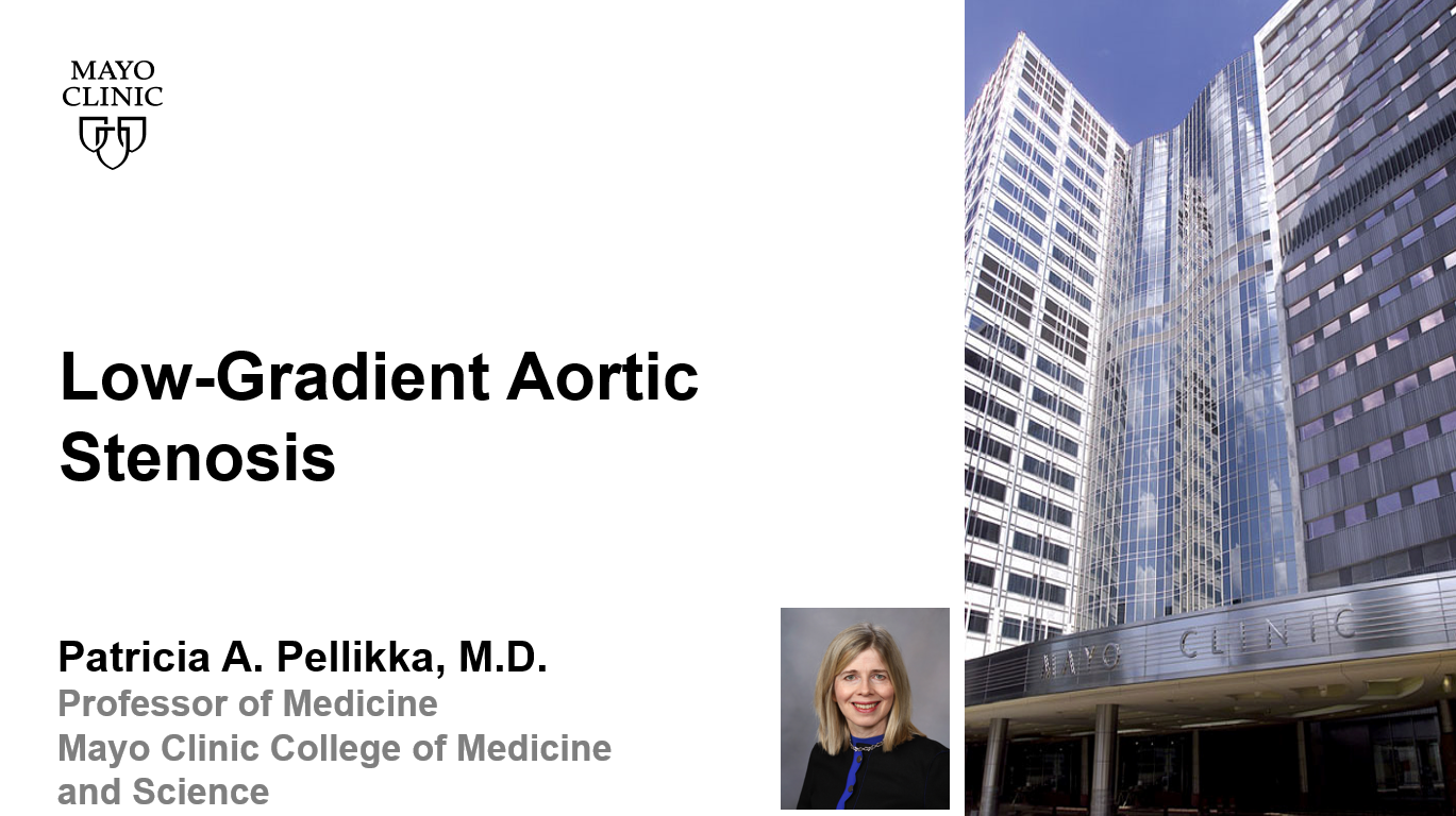 Pellikka low gradient aortic stenosis