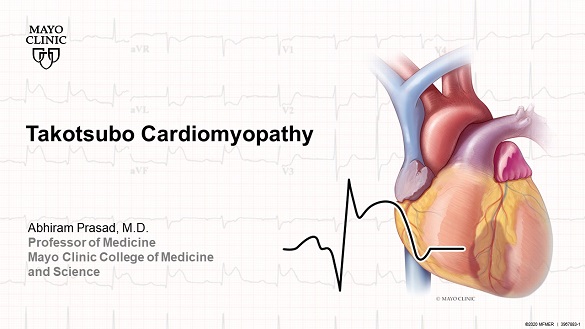 Prasad takotsubo cardiomyopathy