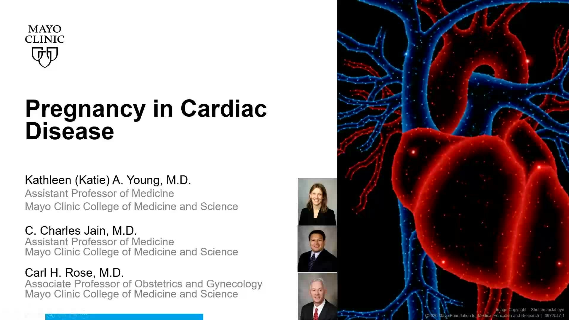 Pregnancy in cardiac disease webinar title slide