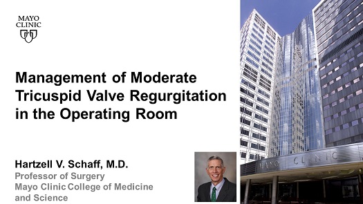 Schaff mgt of moderate tricuspid valve regurg in the or