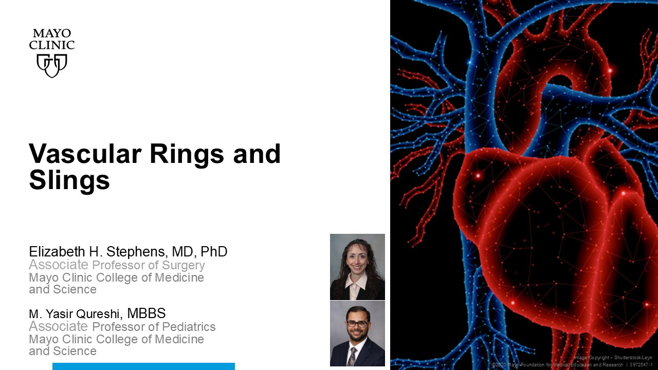 Vascular rings and slings