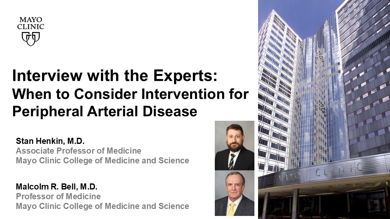 When to consider intervention for pad