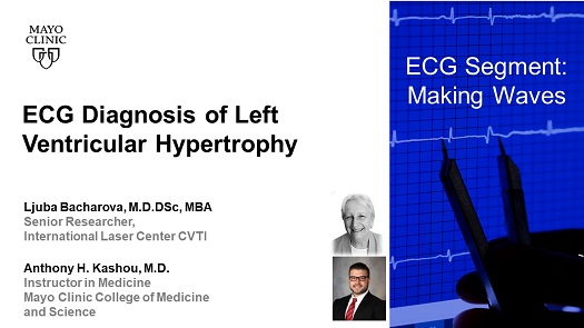 Bacharova kashou ecg diagnosis of left ventricular hypertrophy
